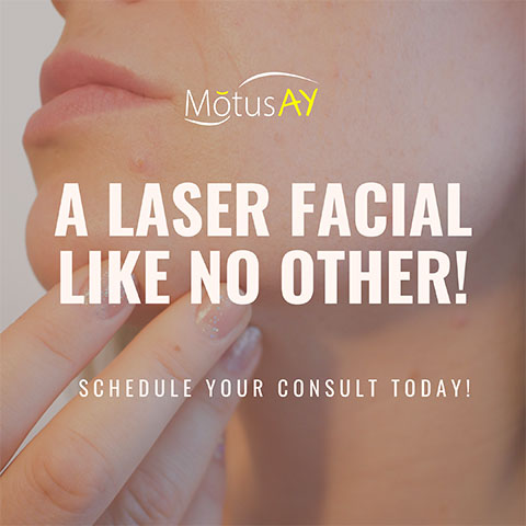 ND YAG Laser treatments available at Beauty Bar Medispa